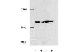 The anti-HDAC1 Pab (ABIN387945 and ABIN2844611) was used in Western Blot to detect HDAC1 in HE cells.