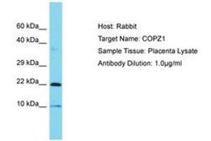 Image no. 1 for anti-Coatomer Protein Complex, Subunit zeta 1 (COPZ1) (C-Term) antibody (ABIN6750829) (COPZ1 anticorps  (C-Term))