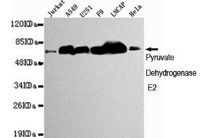 Western blot detection of Pyruvate Dehydrogenase E2 in Jurkat,A549,,F9,Lncap and Hela cell lysates using Pyruvate Dehydrogenase E2 mouse mAb (1:1000 diluted). (CYB561 anticorps)