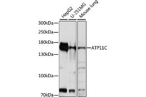 Western blot analysis of extracts of various cell lines, using C antibody (ABIN7265757) at 1:1000 dilution. (ATP11C anticorps  (AA 430-650))