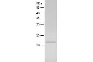 Western Blotting (WB) image for Nudix (Nucleoside Diphosphate Linked Moiety X)-Type Motif 2 (NUDT2) (AA 1-147) protein (His tag) (ABIN7124242) (NUDT2 Protein (AA 1-147) (His tag))