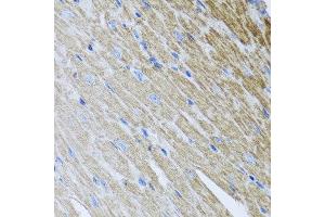 Immunohistochemistry of paraffin-embedded mouse heart using MTX2 antibody at dilution of 1:100 (x40 lens). (MTX2 anticorps)