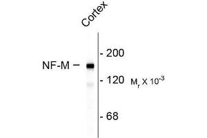 Image no. 1 for anti-Neurofilament Triplet M Protein (NEFM) (C-Term) antibody (ABIN372674) (NEFM anticorps  (C-Term))