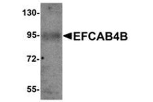 Western blot analysis of EFCAB4B in mouse kidney tissue lysate with EFCAB4B antibody at 1 μg/ml. (EFCAB4B anticorps  (C-Term))