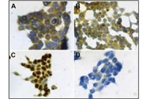 Immunohistochemistry (IHC) image for anti-S100 Calcium Binding Protein A7 (S100A7) antibody (ABIN400722) (S100A7 anticorps)