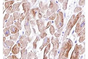 ABIN6267417 at 1/100 staining human Heart muscle tissue sections by IHC-P.