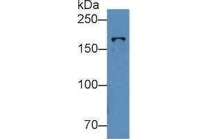 Detection of TOP2b in Human K562 cell lysate using Polyclonal Antibody to Topoisomerase II Beta (TOP2b) (TOP2B anticorps  (AA 446-655))