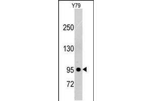 Western blot analysis of anti-PDGFRB Pab in Y79 cell line lysates (35ug/lane). (PDGFRB anticorps)