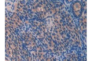 DAB staining on IHC-P; Samples: Mouse Ovary Tissue (PON2 anticorps  (AA 4-289))
