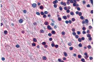 Human Brain, Cerebellum (formalin-fixed, paraffin-embedded) stained with ENO2 antibody ABIN364284 at 20 ug/ml followed by biotinylated anti-mouse IgG secondary antibody ABIN481714, alkaline phosphatase-streptavidin and chromogen. (ENO2/NSE anticorps)