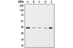 Western blot analysis of GAPDH expression in HepG2 (A), K562 (B), NIH3T3 (C), Raw264. (GAPDH anticorps  (N-Term))