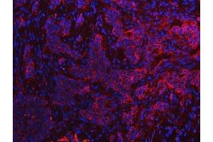 IF analysis of S100A10 using anti-S100A10 antibody (ABIN5692833).
