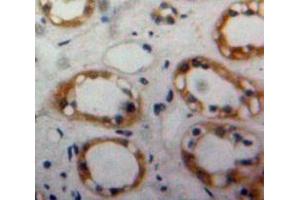 Used in DAB staining on fromalin fixed paraffin-embedded Kidney tissue (BMPR2 anticorps  (AA 27-150))