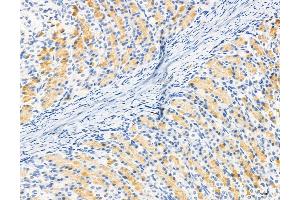 ABIN6264119 and ABIN6272974 at 1/100 staining Rat stomach tissue by IHC-P. (PDLIM7 anticorps  (N-Term))