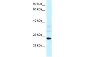 Image no. 1 for anti-Vacuolar-sorting Protein SNF8 (SNF8) (AA 25-74) antibody (ABIN6747424) (SNF8 anticorps  (AA 25-74))