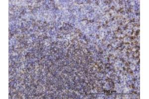 Image no. 1 for anti-Membrane-Spanning 4-Domains, Subfamily A, Member 1 (MS4A1) (AA 1-298) antibody (ABIN598515) (CD20 anticorps  (AA 1-298))