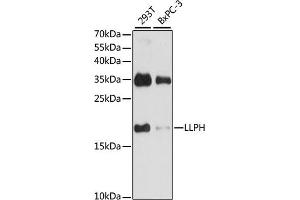 Western blot analysis of extracts of various cell lines, using LLPH antibody (ABIN7268290) at 1:1000 dilution. (LLPH anticorps  (AA 1-129))