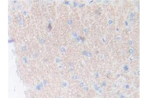 IHC-P analysis of Rat Cerebrum Tissue, with DAB staining. (Thrombopoietin anticorps  (AA 24-266))
