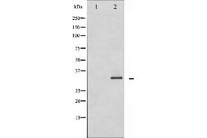 Western blot analysis of Caspase 3 phosphorylation expression in Etoposide treated Jurkat whole cell lysates,The lane on the left is treated with the antigen-specific peptide. (Caspase 3 anticorps  (pSer150))