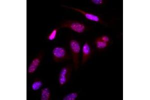 Immunofluorescence (IF) image for anti-Small Ubiquitin Related Modifier 2 (SUMO2) (AA 1-93), (N-Term) antibody (ABIN492386) (SUMO2 anticorps  (N-Term))