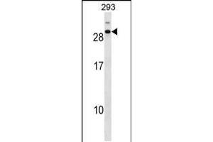 Western blot analysis in 293 cell line lysates (35ug/lane). (CDCA4 anticorps  (C-Term))