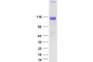 Validation with Western Blot
