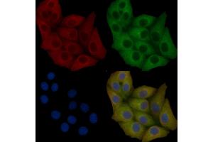 c-Met Mouse Monoclonal Antibody staining Hela cells by IF/ICC. (c-MET anticorps  (C-Term))