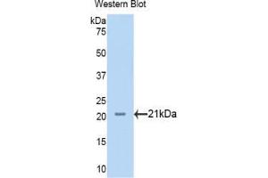 Western blot analysis of the recombinant protein. (Neuropilin 1 anticorps  (AA 646-814))