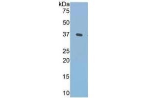 WB of Protein Standard: different control antibodies against Highly purified E.