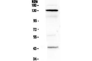 Western blot analysis of VE Cadherin using anti-VE Cadherin antibody . (Cadherin 5 anticorps  (AA 48-272))