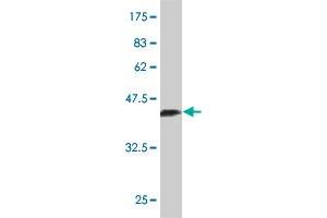 Western Blot detection against Immunogen (37.