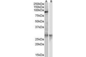 Image no. 1 for anti-Acetyl LDL Receptor (SCARF1) (Internal Region) antibody (ABIN374467) (SCARF1 anticorps  (Internal Region))