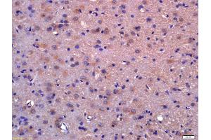 Formalin-fixed and paraffin embedded rat brain labeled with Anti-LDOC1/BCUR1 Polyclonal Antibody, Unconjugated (ABIN717836) at 1:200 followed by conjugation to the secondary antibody and DAB staining (LDOC1 anticorps  (AA 65-146))