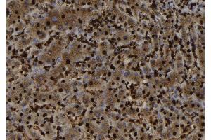 ABIN6279817 at 1/100 staining Human liver tissue by IHC-P. (SH3BGRL anticorps  (Internal Region))