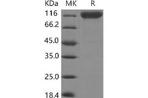 Western Blotting (WB) image for Myelin Associated Glycoprotein (MAG) protein (Fc Tag,ECD) (ABIN7197064)