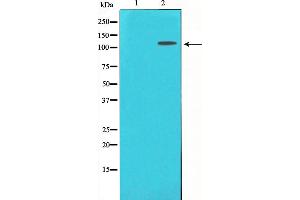 Western blot analysis of CD130/gp130 expression in Jurkat whole cell lysates,The lane on the left is treated with the antigen-specific peptide. (CD130/gp130 anticorps  (C-Term))