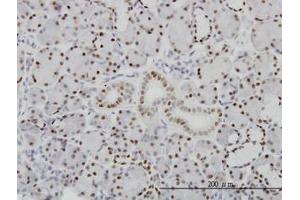 Image no. 1 for anti-Pre-B-Cell Leukemia Homeobox Protein 1 (PBX1) (AA 213-322) antibody (ABIN598855) (PBX1 anticorps  (AA 213-322))