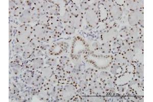 Image no. 1 for anti-Pre-B-Cell Leukemia Homeobox Protein 1 (PBX1) (AA 213-322) antibody (ABIN598855) (PBX1 anticorps  (AA 213-322))