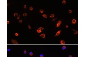 Immunofluorescence analysis of L929 cells using ARL13B Polyclonal Antibody at dilution of 1:100. (ARL13B anticorps)