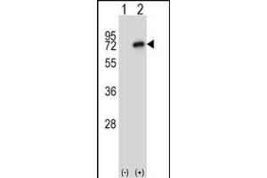 Western blot analysis of Nek8 (arrow) using rabbit polyclonal Mouse Nek8 Antibody (C-term) (ABIN657848 and ABIN2846809). (NEK8 anticorps  (C-Term))