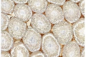 ABIN6265713 and ABIN6272897 at 1/100 staining Rat testis tissue by IHC-P. (TAGLN2 anticorps  (Internal Region))