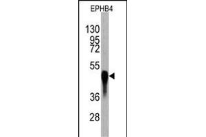 Western blot analysis of anti-EPHB4 Monoclonal Antibody (ABIN387814 and ABIN2843904) by EPHB4 recombinant protein(Fragment).