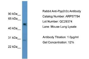 WB Suggested Anti-Ppp2r2c  Antibody Titration: 0. (PPP2R2C anticorps  (N-Term))