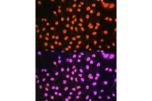 Immunofluorescence analysis of HeLa cells using hnRNP  Rabbit mAb (1564) at dilution of 1:100 (40x lens).