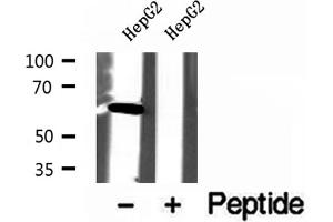 Western blot analysis of extracts of HepG2 cells, using USP39 antibody. (USP39 anticorps  (N-Term))