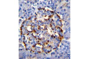 Immunohistochemistry (IHC) image for anti-Phospholipase A2, Group IID (PLA2G2D) antibody (ABIN2996055) (PLA2G2D anticorps)