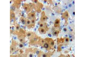 Used in DAB staining on fromalin fixed paraffin-embedded Liver tissue (FOXO1 anticorps  (AA 222-469))