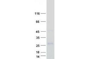 Validation with Western Blot