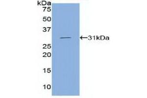 Western blot analysis of recombinant Human CDH5.