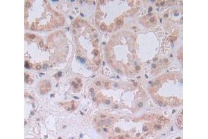 Used in DAB staining on fromalin fixed paraffin- embedded Kidney tissue (UMPS anticorps  (AA 205-480))